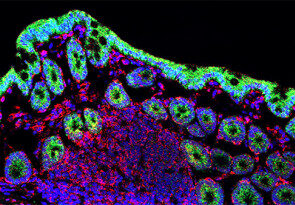 Kanvas Biosciences raises $48 million to advance microbiome cancer therapies